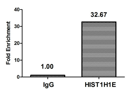 HIST1H1E Antibody - Chromatin Immunoprecipitation Hela (4*10E6, treated with 30mM sodium butyrate for 4h) were treated with Micrococcal Nuclease, sonicated, and immunoprecipitated with 5µg anti-HIST1H1E (Acetyl-HIST1H1E (K63) Antibody) or a control normal rabbit IgG. The resulting ChIP DNA was quantified using real-time PCR with primers against the ß-Globin promoter.