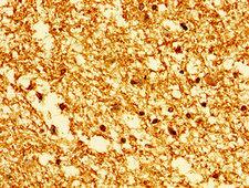 HIST1H1E Antibody - Immunohistochemistry image of paraffin-embedded human brain tissue at a dilution of 1:100