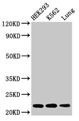 HIST1H1E Antibody - Positive Western Blot detected in HEK293 whole cell lysate, K562 whole cell lysate, Mouse lung tissue. All lanes: HIST1H1E antibody at 1.5 µg/ml Secondary Goat polyclonal to rabbit IgG at 1/50000 dilution. Predicted band size: 22 KDa. Observed band size: 22 KDa