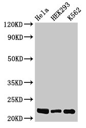 HIST1H1E Antibody - Positive Western Blot detected in Hela whole cell lysate, HEK293 whole cell lysate, K562 whole cell lysate. All lanes: HIST1H1E antibody at 0.5 µg/ml Secondary Goat polyclonal to rabbit IgG at 1/50000 dilution. Predicted band size: 22 KDa. Observed band size: 22 KDa