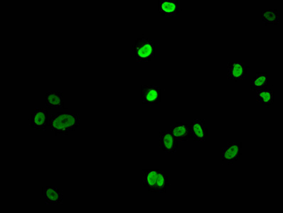 HIST1H1E Antibody - Immunofluorescent analysis of MCF-7 (sodium butyrate, 30 mM, 4h) cells at a dilution of 1:100 and Alexa Fluor 488-congugated AffiniPure Goat Anti-Rabbit IgG(H+L)