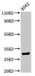 HIST1H1E Antibody - Positive Western Blot detected in K562 whole cell lysate. All lanes: HIST1H1E antibody at 0.5 µg/ml Secondary Goat polyclonal to rabbit IgG at 1/50000 dilution. Predicted band size: 32 KDa. Observed band size: 32 KDa