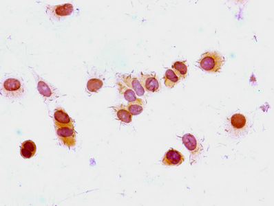 HIST1H1E Antibody - Immunocytochemistry analysis of MCF-7 cells at a dilution of 1:100