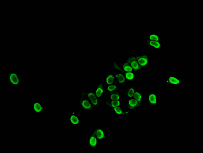 HIST1H1E Antibody - Immunofluorescent analysis of MCF-7 cells (sodium butyrate, 30 mM, 4h) at a dilution of 1:100 and Alexa Fluor 488-congugated AffiniPure Goat Anti-Rabbit IgG(H+L)