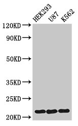 HIST1H1E Antibody - Positive Western Blot detected in HEK293 whole cell lysate, U87 whole cell lysate, K562 whole cell lysate. All lanes: HIST1H1E antibody at 1.5 µg/ml Secondary Goat polyclonal to rabbit IgG at 1/50000 dilution. Predicted band size: 22 KDa. Observed band size: 22 KDa