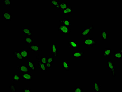 HIST1H1E Antibody - Immunofluorescent analysis of Hela cells at a dilution of 1:100 and Alexa Fluor 488-congugated AffiniPure Goat Anti-Rabbit IgG(H+L)