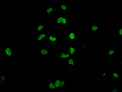 HIST1H1E Antibody - Immunofluorescent analysis of MCF-7 cells at a dilution of 1:100 and Alexa Fluor 488-congugated AffiniPure Goat Anti-Rabbit IgG(H+L)