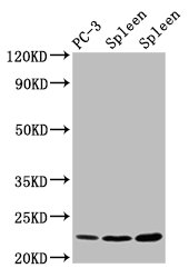 HIST1H1E Antibody - Positive Western Blot detected in PC3 whole cell lysate, Rat spleen tissue, Mouse spleen tissue. All lanes: HIST1H1D antibody at 1.5 µg/ml Secondary Goat polyclonal to rabbit IgG at 1/50000 dilution. Predicted band size: 23 KDa. Observed band size: 23 KDa