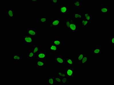 HIST1H1E Antibody - Immunofluorescence staining of hela with DAPI. The cells were fixed in 4% formaldehyde, permeabilized using 0.2% Triton X-100 and blocked in 10% normal Goat Serum. The cells were then incubated with the antibody overnight at 4 °C.The secondary antibody was Alexa Fluor 488-congugated AffiniPure Goat Anti-Rabbit IgG (H+L) .