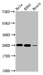 HIST1H1E Antibody - Positive Western Blot detected in Hela whole cell lysate, K562 whole cell lysate, Rat brain tissue. All lanes: HIST1H1E antibody at 1.48 µg/ml Secondary Goat polyclonal to rabbit IgG at 1/50000 dilution. Predicted band size: 28 KDa. Observed band size: 28 KDa