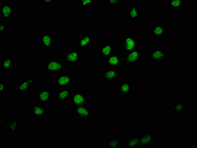 HIST1H1E Antibody - Immunofluorescence staining of hela with DAPI. The cells were fixed in 4% formaldehyde, permeabilized using 0.2% Triton X-100 and blocked in 10% normal Goat Serum. The cells were then incubated with the antibody overnight at 4 °C.The secondary antibody was Alexa Fluor 488-congugated AffiniPure Goat Anti-Rabbit IgG (H+L) .