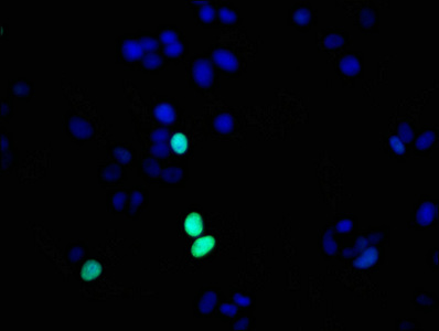 HIST1H1E Antibody - Immunofluorescence staining of MCF-7 cells diluted at 1:56,counter-stained with DAPI. The cells were fixed in 4% formaldehyde, permeabilized using 0.2% Triton X-100 and blocked in 10% normal Goat Serum. The cells were then incubated with the antibody overnight at 4°C.The Secondary antibody was Alexa Fluor 488-congugated AffiniPure Goat Anti-Rabbit IgG (H+L).