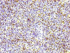 HIST1H1E Antibody - Immunohistochemistry Dilution at 1:100 and staining in paraffin-embedded human lymph node tissue performed on a Leica BondTM system. After dewaxing and hydration, antigen retrieval was mediated by high pressure in a citrate buffer (pH 6.0). Section was blocked with 10% normal Goat serum 30min at RT. Then primary antibody (1% BSA) was incubated at 4°C overnight. The primary is detected by a biotinylated Secondary antibody and visualized using an HRP conjugated SP system.