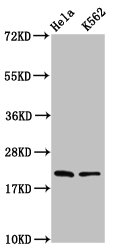 HIST1H1E Antibody - Western Blot Positive WB detected in: Hela whole cell lysate, K562 whole cell lysate All Lanes: HIST1H1D antibody at 1.25µg/ml Secondary Goat polyclonal to rabbit IgG at 1/50000 dilution Predicted band size: 23 KDa Observed band size: 23 KDa