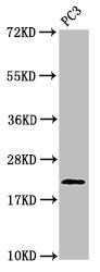 HIST1H1E Antibody - Positive Western Blot detected in PC3 whole cell lysate. All lanes: HIST1H1D antibody at 1 µg/ml Secondary Goat polyclonal to rabbit IgG at 1/50000 dilution. Predicted band size: 23 KDa. Observed band size: 23 KDa