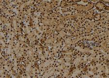 HIST1H1E Antibody - 1:100 staining mouse kidney tissue by IHC-P. The sample was formaldehyde fixed and a heat mediated antigen retrieval step in citrate buffer was performed. The sample was then blocked and incubated with the antibody for 1.5 hours at 22°C. An HRP conjugated goat anti-rabbit antibody was used as the secondary.