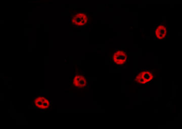 HIST1H1E Antibody - Staining HepG2 cells by IF/ICC. The samples were fixed with PFA and permeabilized in 0.1% Triton X-100, then blocked in 10% serum for 45 min at 25°C. The primary antibody was diluted at 1:200 and incubated with the sample for 1 hour at 37°C. An Alexa Fluor 594 conjugated goat anti-rabbit IgG (H+L) Ab, diluted at 1/600, was used as the secondary antibody.
