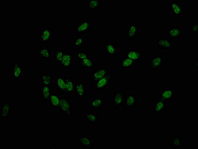 HIST1H1E Antibody - Immunofluorescence staining of hela at a dilution of 1:25, counter-stained with DAPI. The cells were fixed in 4% formaldehyde, permeabilized using 0.2% Triton X-100 and blocked in 10% normal Goat Serum. The cells were then incubated with the antibody overnight at 4 °C.The secondary antibody was Alexa Fluor 488-congugated AffiniPure Goat Anti-Rabbit IgG (H+L) .