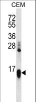 HIST1H2AA Antibody - HIST1H2AA Antibody western blot of CEM cell line lysates (35 ug/lane). The HIST1H2AA antibody detected the HIST1H2AA protein (arrow).