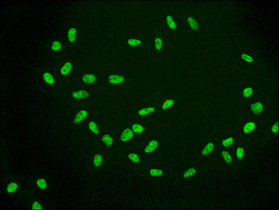 HIST1H2AB Antibody - Immunofluorescence staining of Hela cells (treated by 15mM sodium butyrate for 30min) diluted at 1:56,counter-stained with DAPI. The cells were fixed in 4% formaldehyde, permeabilized using 0.2% Triton X-100 and blocked in 10% normal Goat Serum. The cells were then incubated with the antibody overnight at 4°C.The Secondary antibody was Alexa Fluor 488-congugated AffiniPure Goat Anti-Rabbit IgG (H+L).