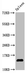 HIST1H2AB Antibody - Western Blot Positive WB detected in:Mouse spleen tissue All Lanes:Hydroxyl-Histone H2A type 1-B/E (Y39) antibody at 1.05µg/ml Secondary Goat polyclonal to rabbit IgG at 1/50000 dilution Predicted band size: 14 KDa Observed band size: 14 KDa