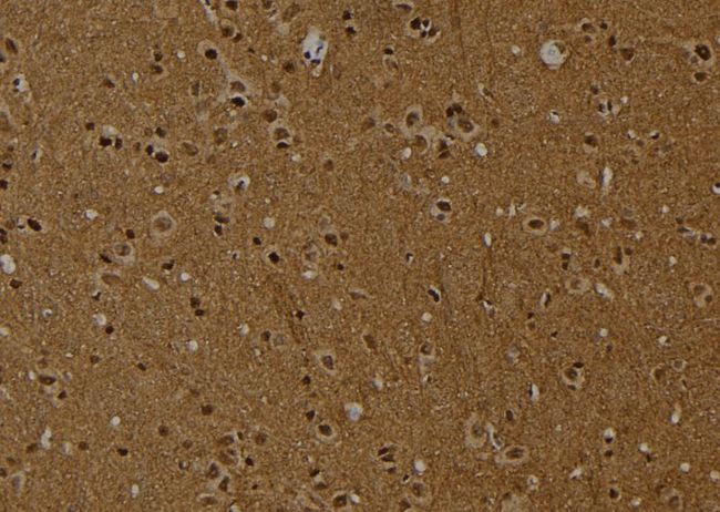 HIST1H2AE Antibody - 1:100 staining rat brain tissue by IHC-P. The sample was formaldehyde fixed and a heat mediated antigen retrieval step in citrate buffer was performed. The sample was then blocked and incubated with the antibody for 1.5 hours at 22°C. An HRP conjugated goat anti-rabbit antibody was used as the secondary.