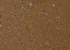 HIST1H2AE Antibody - 1:100 staining rat brain tissue by IHC-P. The sample was formaldehyde fixed and a heat mediated antigen retrieval step in citrate buffer was performed. The sample was then blocked and incubated with the antibody for 1.5 hours at 22°C. An HRP conjugated goat anti-rabbit antibody was used as the secondary.