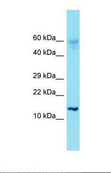 HIST1H2AE Antibody - Western blot of Human RPMI-8226. HIST1H2AE antibody dilution 1.0 ug/ml.  This image was taken for the unconjugated form of this product. Other forms have not been tested.