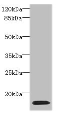 HIST1H2AG Antibody - Western blot All lanes: HIST1H2AG antibody at 4µg/ml + HL60 whole cell lysate Secondary Goat polyclonal to rabbit IgG at 1/10000 dilution Predicted band size: 14 kDa Observed band size: 14 kDa