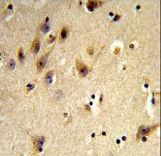 HIST1H2AH Antibody - Formalin-fixed and paraffin-embedded human brain tissue reacted with HIST1H2AH Antibody , which was peroxidase-conjugated to the secondary antibody, followed by DAB staining. This data demonstrates the use of this antibody for immunohistochemistry; clinical relevance has not been evaluated.