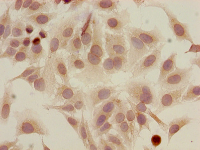 HIST1H2AI Antibody - Immunocytochemistry analysis of Hela cells at a dilution of 1:100