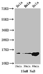 HIST1H2AI Antibody - Positive Western Blot detected in Hela cell acid extracts treated by NaB. All lanes: HIST1H2AG antibody at 1.5 µg/ml Secondary Goat polyclonal to rabbit IgG at 1/50000 dilution. Predicted band size: 15 KDa. Observed band size: 15 KDa