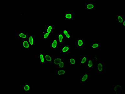 HIST1H2AI Antibody - Immunofluorescent analysis of Hela cells (sodium butyrate, 30 mM, 4h) at a dilution of 1:100 and Alexa Fluor 488-congugated AffiniPure Goat Anti-Rabbit IgG(H+L)