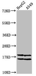 HIST1H2AI Antibody - Western Blot Positive WB detected in: HepG2 whole cell lysate, A549 whole cell lysate (All treated with 30mM sodium butyrate for 4h) All lanes: HIST1H2AG antibody at 1µg/ml Secondary Goat polyclonal to rabbit IgG at 1/50000 dilution Predicted band size: 15 kDa Observed band size: 15 kDa