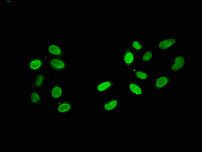 HIST1H2AI Antibody - Immunofluorescence staining of Hela cells with HIST1H2AG (Ab-119) Antibody at 1:5, counter-stained with DAPI. The cells were fixed in 4% formaldehyde, permeabilized using 0.2% Triton X-100 and blocked in 10% normal Goat Serum. The cells were then incubated with the antibody overnight at 4°C. The secondary antibody was Alexa Fluor 488-congugated AffiniPure Goat Anti-Rabbit IgG(H+L).
