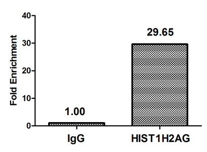HIST1H2AI Antibody - Chromatin Immunoprecipitation Hela (4*10E6) were treated with Micrococcal Nuclease, sonicated, and immunoprecipitated with 5µg anti-HIST1H2AG (HIST1H2AG (Ab-119) Antibody) or a control normal rabbit IgG. The resulting ChIP DNA was quantified using real-time PCR with primers against the ß-Globin promoter.