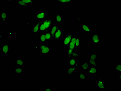 HIST1H2AI Antibody - Immunofluorescent analysis of Hela cells(sodium butyrate, 30 mM, 4h) at a dilution of 1:100 and Alexa Fluor 488-congugated AffiniPure Goat Anti-Rabbit IgG(H+L)