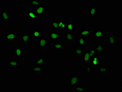 HIST1H2AI Antibody - Immunofluorescence staining of hela with DAPI. The cells were fixed in 4% formaldehyde, permeabilized using 0.2% Triton X-100 and blocked in 10% normal Goat Serum. The cells were then incubated with the antibody overnight at 4 °C.The secondary antibody was Alexa Fluor 488-congugated AffiniPure Goat Anti-Rabbit IgG (H+L) .