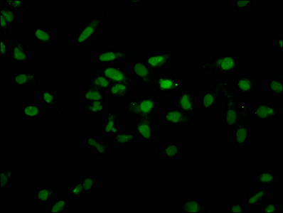 HIST1H2AI Antibody - Immunofluorescence staining of hela with DAPI. The cells were fixed in 4% formaldehyde, permeabilized using 0.2% Triton X-100 and blocked in 10% normal Goat Serum. The cells were then incubated with the antibody overnight at 4°C.The secondary antibody was Alexa Fluor 488-congugated AffiniPure Goat Anti-Rabbit IgG (H+L) .