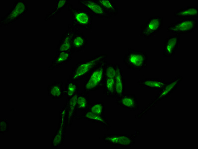 HIST1H2AI Antibody - Immunofluorescence staining of hela with DAPI. The cells were fixed in 4% formaldehyde, permeabilized using 0.2% Triton X-100 and blocked in 10% normal Goat Serum. The cells were then incubated with the antibody overnight at 4 °C.The secondary antibody was Alexa Fluor 488-congugated AffiniPure Goat Anti-Rabbit IgG (H+L) .