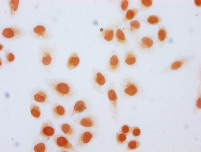 HIST1H2AI Antibody - Immunocytochemistry analysis diluted at 1:20 and staining in Hela cells(treated with 30mM sodium butyrate for 4h) performed on a Leica BondTM system. The cells were fixed in 4% formaldehyde, permeabilized using 0.2% Triton X-100 and blocked with 10% normal Goat serum 30min at RT. Then primary antibody (1% BSA) was incubated at 4°C overnight. The primary is detected by a biotinylated Secondary antibody and visualized using an HRP conjugated SP system.