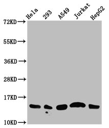HIST1H2AI Antibody - Western Blot Positive WB detected in: Hela whole cell lysate, 293 whole cell lysate, A549 whole cell lysate, Jurkat whole cell lysate, HepG2 whole cell lysate(all treated with 30mM sodium butyrate for 4h) All Lanes: HIST1H2AG antibody at 1.25µg/ml Secondary Goat polyclonal to rabbit IgG at 1/50000 dilution Predicted band size: 15 KDa Observed band size: 15 KDa