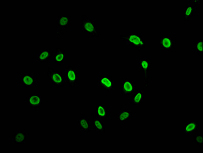 HIST1H2AI Antibody - Immunofluorescence staining of Hela cells (treated with 30mM sodium butyrate for 4h) diluted at 1:2.5, counter-stained with DAPI. The cells were fixed in 4% formaldehyde, permeabilized using 0.2% Triton X-100 and blocked in 10% normal Goat Serum. The cells were then incubated with the antibody overnight at 4°C.The Secondary antibody was Alexa Fluor 488-congugated AffiniPure Goat Anti-Rabbit IgG (H+L) .
