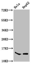 HIST1H2AI Antibody - Western Blot Positive WB detected in: Hela whole cell lysate, HepG2 whole cell lysate(all treated with 30mM sodium butyrate for 4h) All Lanes: HIST1H2AG antibody at 1.1µg/ml Secondary Goat polyclonal to rabbit IgG at 1/50000 dilution Predicted band size: 15 KDa Observed band size: 15 KDa