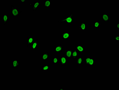 HIST1H2AI Antibody - Immunofluorescence staining of Hela cells (treated with 30mM sodium butyrate for 4h) diluted at 1:1.5, counter-stained with DAPI. The cells were fixed in 4% formaldehyde, permeabilized using 0.2% Triton X-100 and blocked in 10% normal Goat Serum. The cells were then incubated with the antibody overnight at 4°C.The Secondary antibody was Alexa Fluor 488-congugated AffiniPure Goat Anti-Rabbit IgG (H+L) .