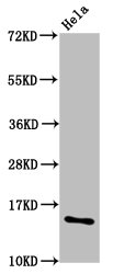 HIST1H2AI Antibody - Western Blot Positive WB detected in: Hela whole cell lysate(treated with 30mM sodium butyrate for 4h) All Lanes: HIST1H2AG antibody at 1.5µg/ml Secondary Goat polyclonal to rabbit IgG at 1/50000 dilution Predicted band size: 15 KDa Observed band size: 15 KDa