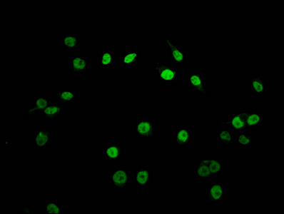 HIST1H2AI Antibody - Immunofluorescence staining of Hela cells (treated with 30mM sodium butyrate for 4h) diluted at 1:7.5, counter-stained with DAPI. The cells were fixed in 4% formaldehyde, permeabilized using 0.2% Triton X-100 and blocked in 10% normal Goat Serum. The cells were then incubated with the antibody overnight at 4°C.The Secondary antibody was Alexa Fluor 488-congugated AffiniPure Goat Anti-Rabbit IgG (H+L) .