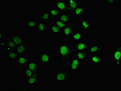 HIST1H2AI Antibody - Immunofluorescence staining of Hela cells with HIST1H2AG (Ab-118) Antibody at 1:5, counter-stained with DAPI. The cells were fixed in 4% formaldehyde, permeabilized using 0.2% Triton X-100 and blocked in 10% normal Goat Serum. The cells were then incubated with the antibody overnight at 4°C. The secondary antibody was Alexa Fluor 488-congugated AffiniPure Goat Anti-Rabbit IgG(H+L).