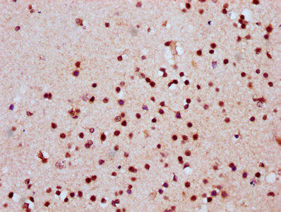 HIST1H2AI Antibody - Immunohistochemistry Dilution at 1:20 and staining in paraffin-embedded human brain tissue performed on a Leica BondTM system. After dewaxing and hydration, antigen retrieval was mediated by high pressure in a citrate buffer (pH 6.0). Section was blocked with 10% normal Goat serum 30min at RT. Then primary antibody (1% BSA) was incubated at 4°C overnight. The primary is detected by a biotinylated Secondary antibody and visualized using an HRP conjugated SP system.