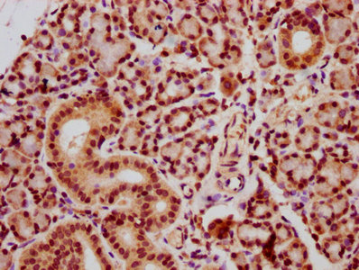 HIST1H2AI Antibody - Immunohistochemistry Dilution at 1:20 and staining in paraffin-embedded human pancreatic tissue performed on a Leica BondTM system. After dewaxing and hydration, antigen retrieval was mediated by high pressure in a citrate buffer (pH 6.0). Section was blocked with 10% normal Goat serum 30min at RT. Then primary antibody (1% BSA) was incubated at 4°C overnight. The primary is detected by a biotinylated Secondary antibody and visualized using an HRP conjugated SP system.